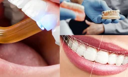 Düzce Özel Diş Klinikleri Hangi Durumlarda Başvurmalı?