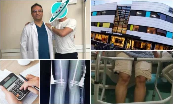 En Ucuz Uzatma Cerrahisi- Cheapest Limb Lengthening Surgery