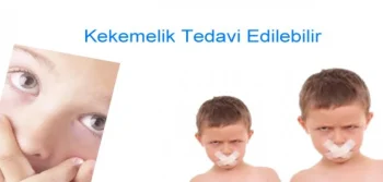 Kekemelik Tedavi Edilebilir mi?