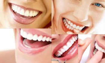 Diş Kozmetiği Yöntemleri İle Gülümsemeniz Artık Daha Güzel!