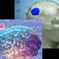 Beyin Tümörü Nedir Hangi Belirtileri Gösterir