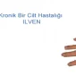 Ilven Hastalığı Nedir?
