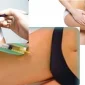 Karboksiterapi Nedir Hangi Durumlarda Uygulanır?